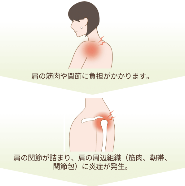 肩