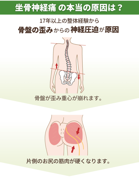 坐骨